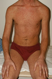 Patient X: Clinical Photos No. 002