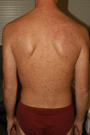 Patient X: Clinical Photos No. 005