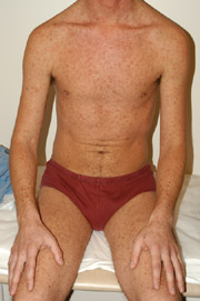 Patient X: Clinical Photos No. 013