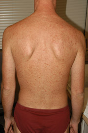 Patient X: Clinical Photos No. 014