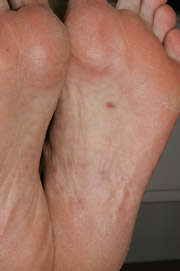 Patient X: Clinical Photos No. 015