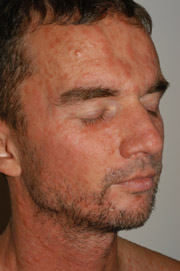 Patient X: Clinical Photos No. 016