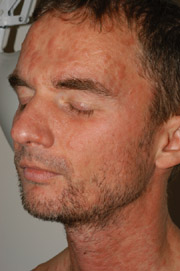 Patient X: Clinical Photos No. 017